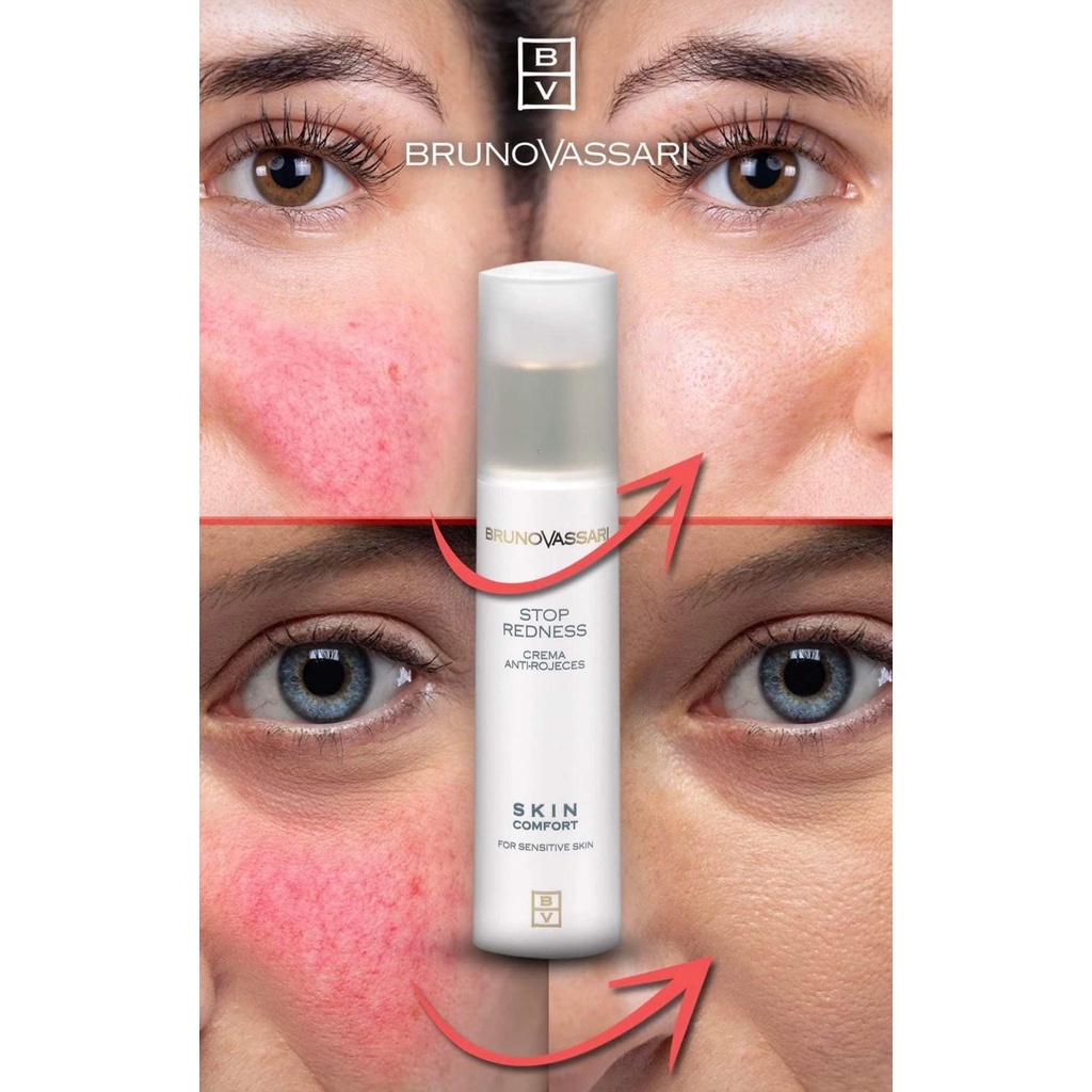 BrunoVassari Skin Comfort – Stop Redness – Kem Cấp Cứu Chống Mẫn Đỏ & Giảm Kích Ứng Cho Da Nhạy Cảm
