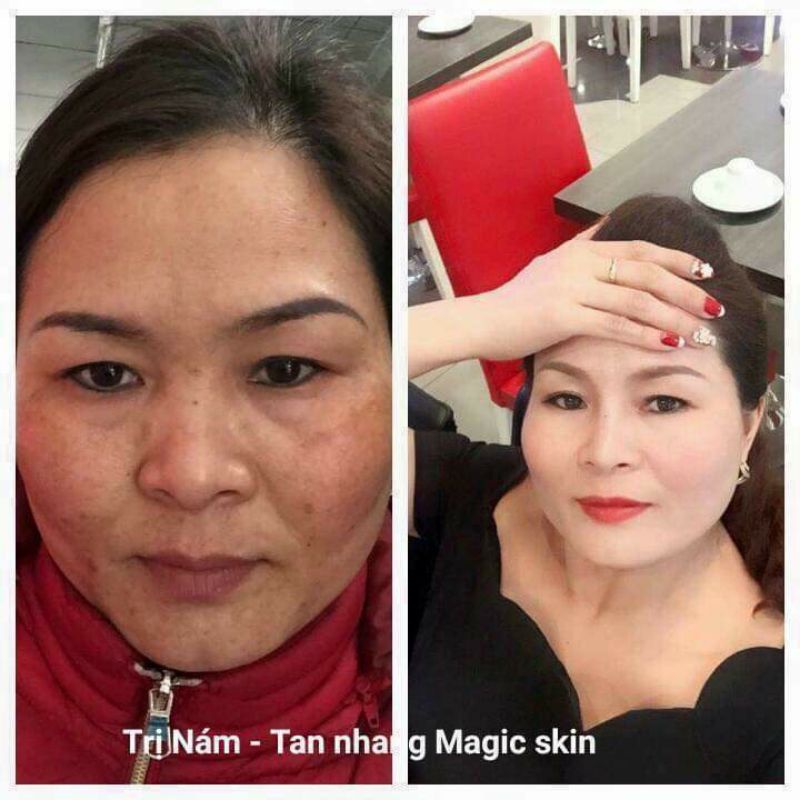 CAO NÁM HOÀNG CUNG MAGIC SKIN HỘP LỚN 40G