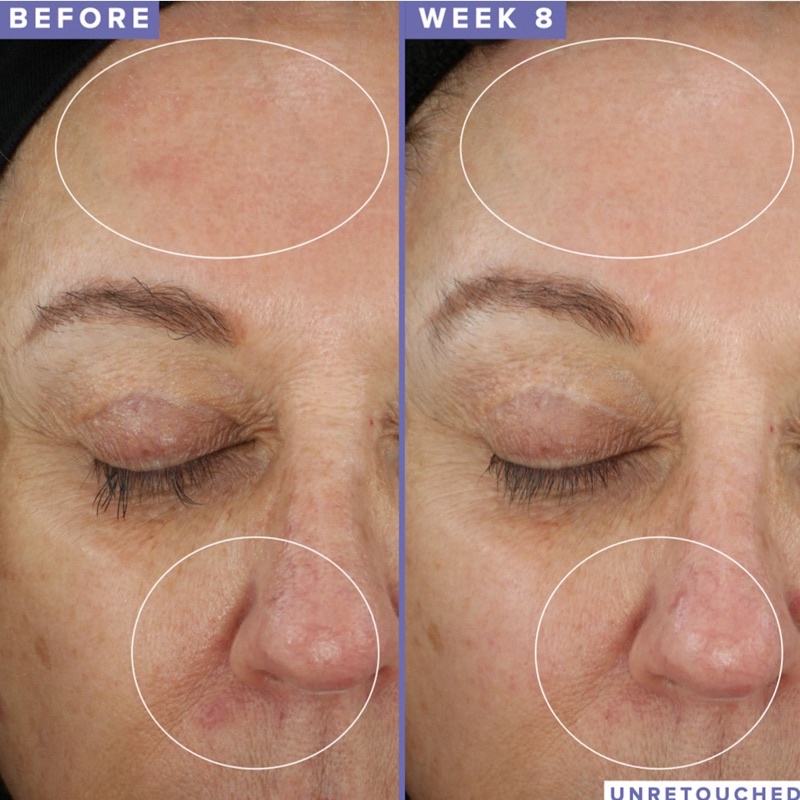 Mặt nạ ngủ Farmacy 10% Niacinamide Night Mask