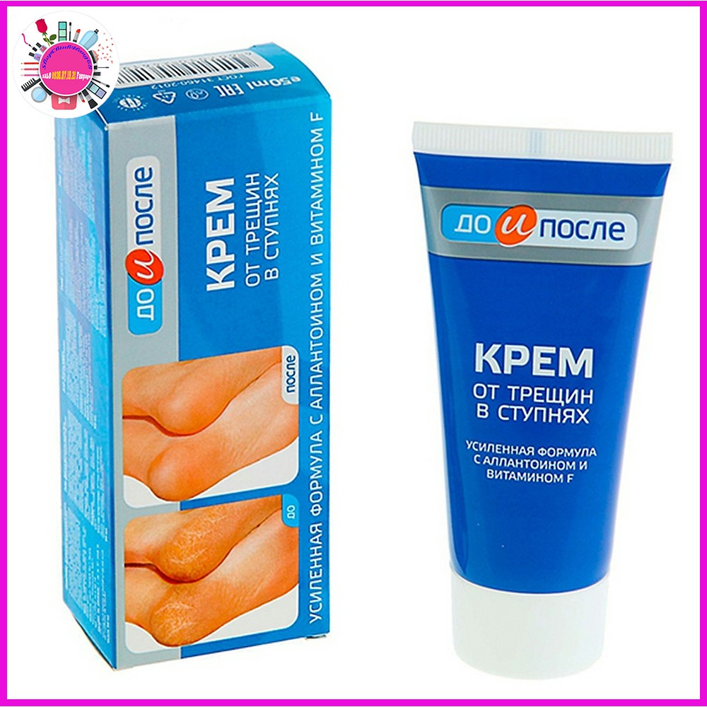 Kem Trị Nứt Gót Chân KPEM Dưỡng Ẩm và Làm Mềm 50ml NGA