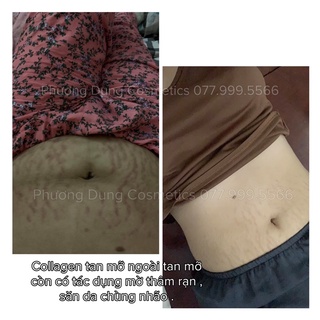 COLLAGEN TAN MỠ SLIMMING DAY