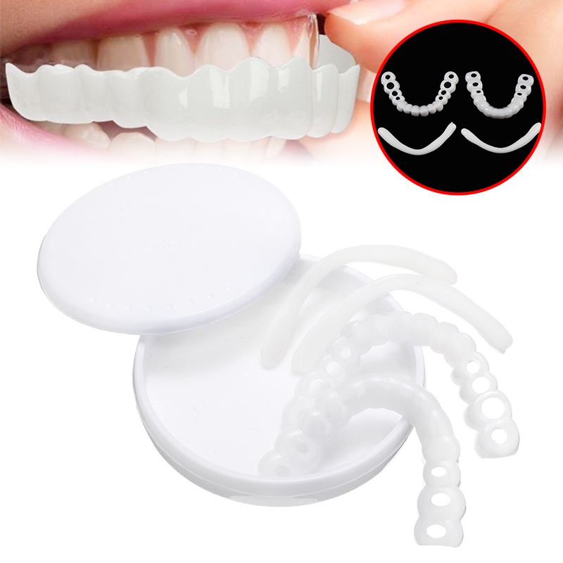 Nha khoa chụp trên nụ cười hoàn hảo tức thì veneers răng thoải mái trên & dưới