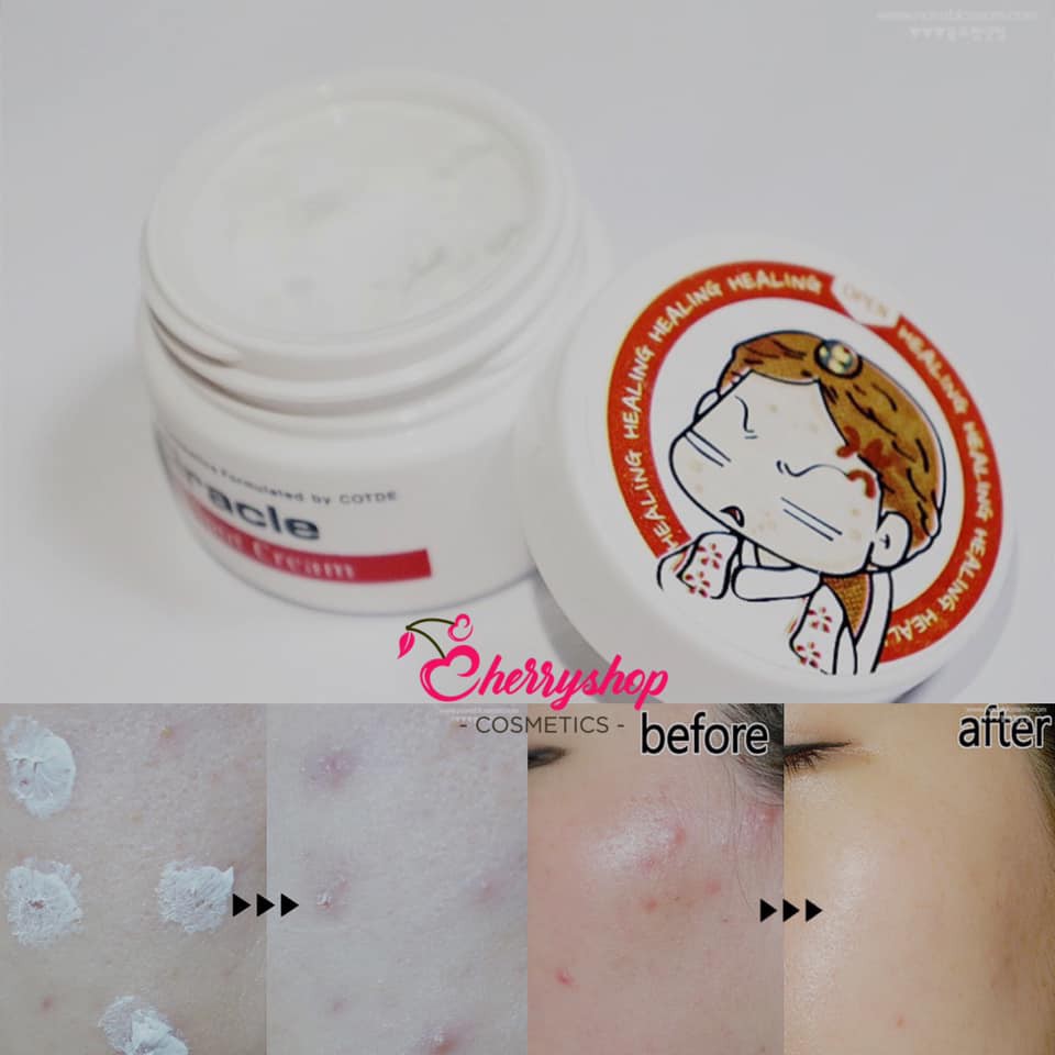 KEM MỤN VÀ VẾT THÂM &quot; - Ciracle Red Spot Cream