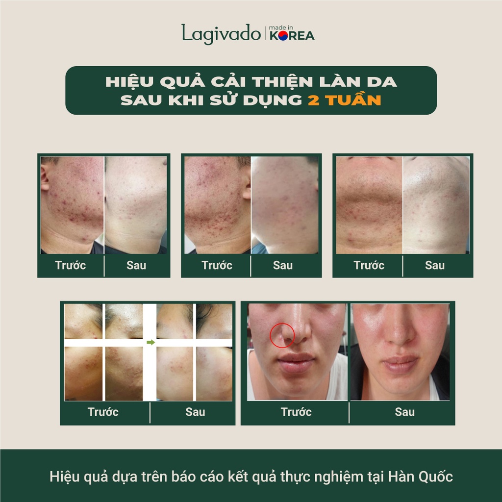Bộ chăm sóc da mặt Hàn Quốc Lagivado gồm Kem chống nắng Multi-Protection 30 g và Dr. ATreat Serum 30 ml