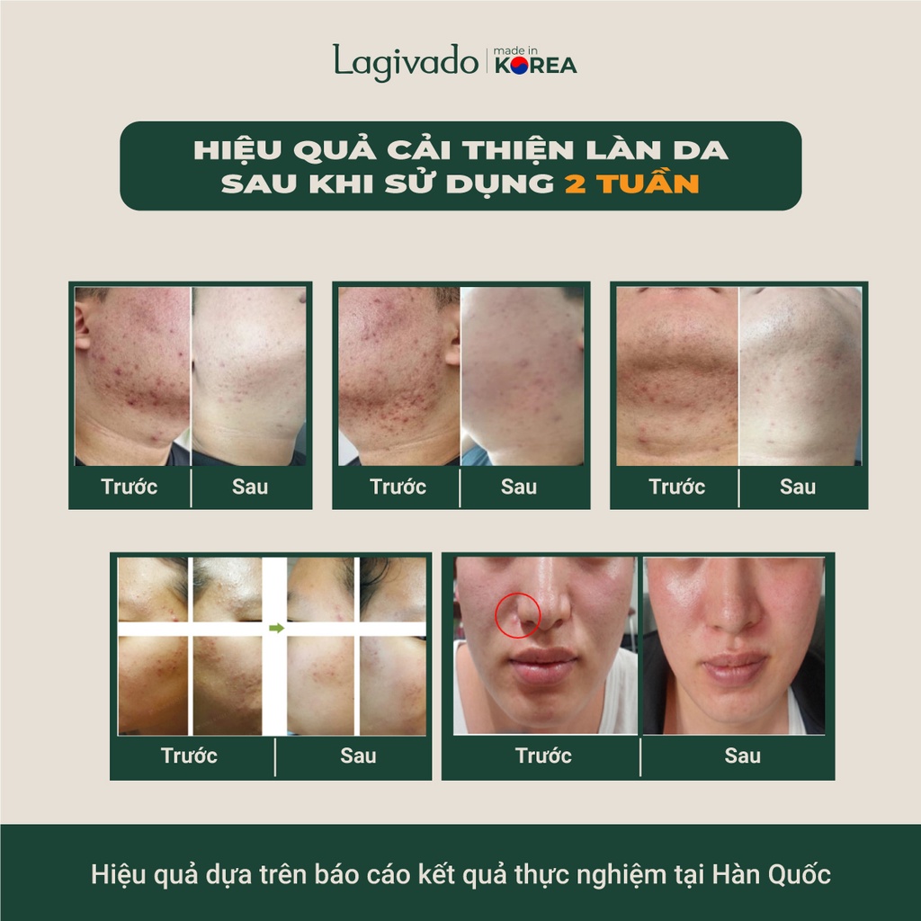 Bộ chăm sóc da mụn Hàn Quốc Lagivado gồm Dr. Atreat Cream 30g &amp; Dr. Atreat Serrum 30ml