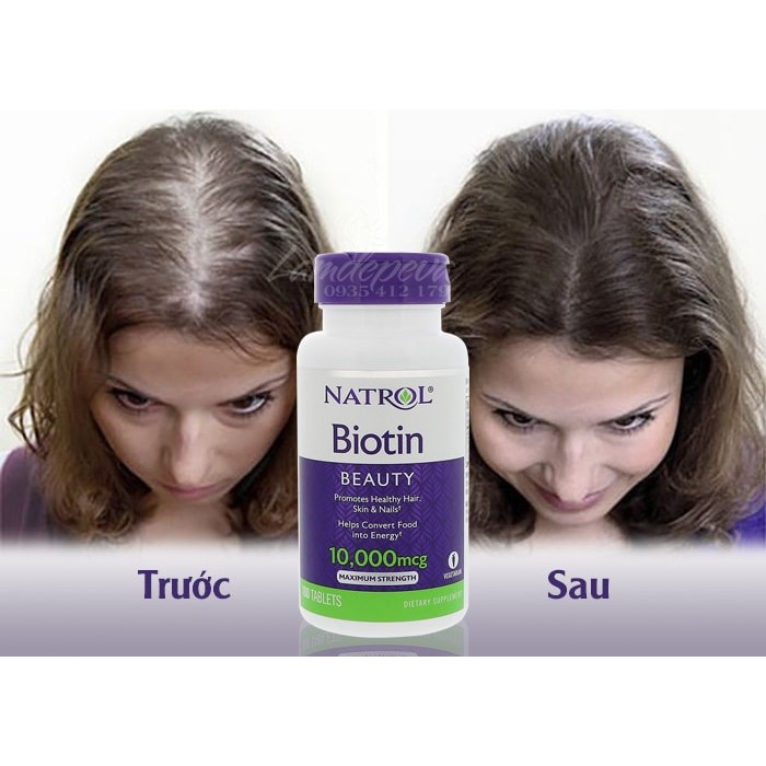 Viên Uống Mọc Tóc Natrol Biotin 10,000mcg Maximum Strength 100 Viên - Hàng Mỹ