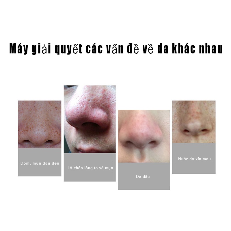Máy Hút Mụn Hút Sạch Tất Cả Các Loại Mụn Với 3 Đầu Hút Thông Minh An Toàn Không Đau Rát Tiện Lợi Làm Sạch Lỗ Chân Lông