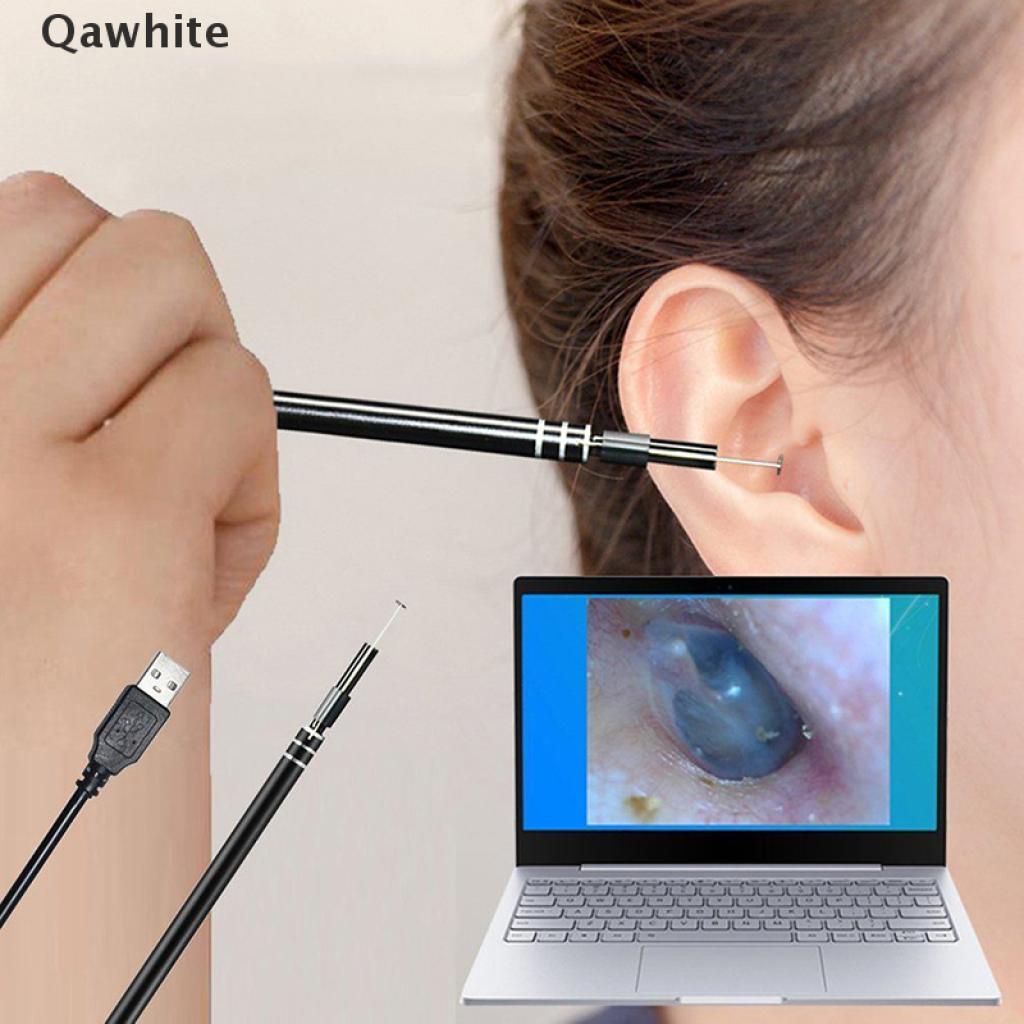 Muỗng Lấy Ráy Tai Nội Soi HD Cổng USB Kèm Camera Mini QC