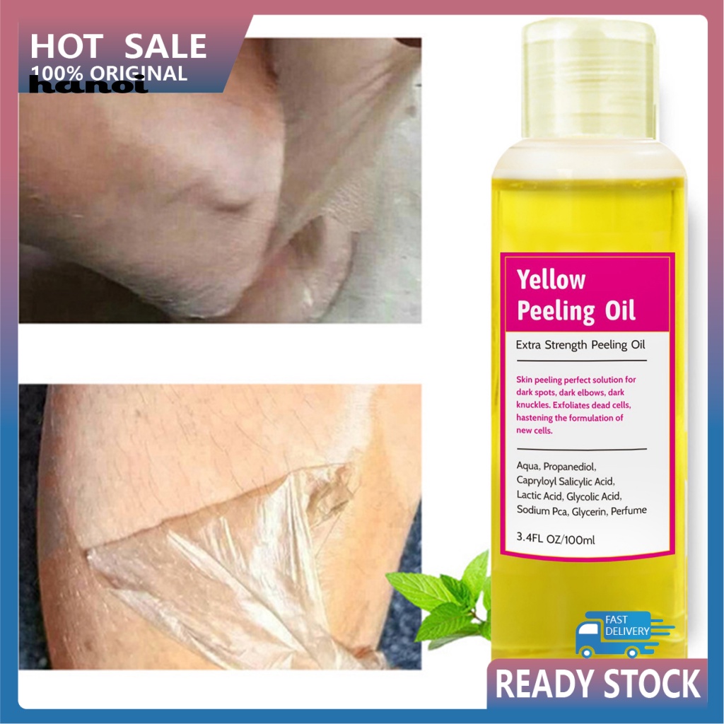 Dầu Lột Làm Trắng Da Hiệu Quả Không Gây Hại Cho Da