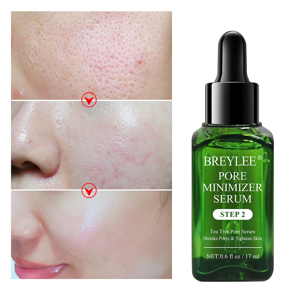 BREYLEE Pore refining serum (step 2）Shrink Pores Get rid of acne marks Skin Care 17ml