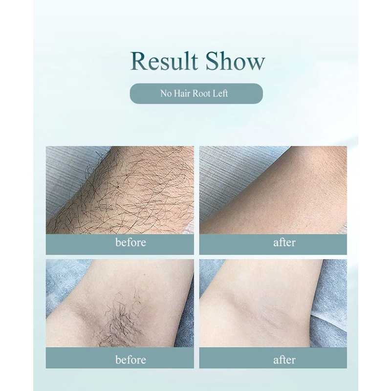 Máy triệt lông bằng Laser 900000 Máy triệt lông bằng Laser IPL Toàn thân vĩnh viễn Thiết bị triệt lông không đau