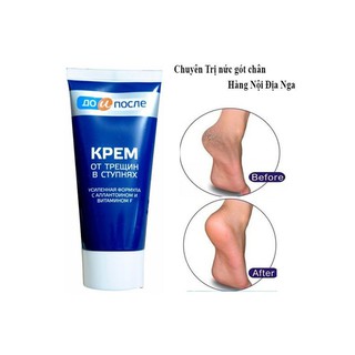 [ Hàng Chính Hãng] Kem Nứt Gót Chân Kpem Nga 50ml