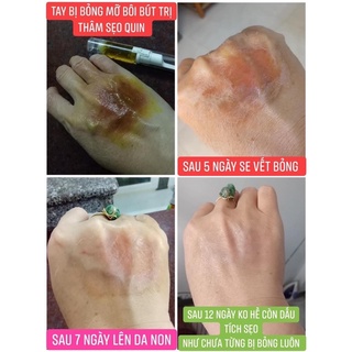 Bút nghệ nano Quin