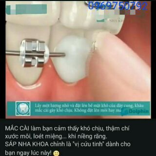 Sáp nha khoa 3M Unitek ( mỹ )