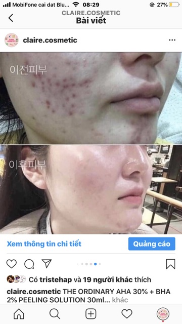 [BILL SEPHORA]THE ORDINARY PEELING SOLUTION AHA BHA TẨY DA CHẾT TẾ BÀO | BigBuy360 - bigbuy360.vn