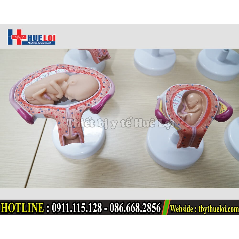 Mô hình thai nhi từ 1 - 9 Tháng - Các giai đoạn phát triển của thai nhựa PVC