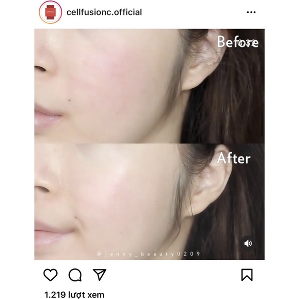Kem chống nắng Laser Sunscreen/ Toning Suncreen/ Cushion Suncreen