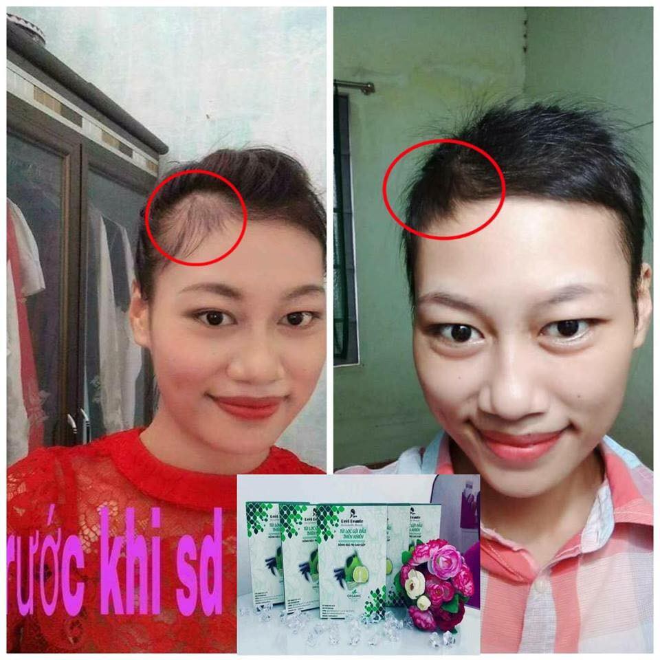 túi lọc gội đầu reel beaute dòng phổ thông