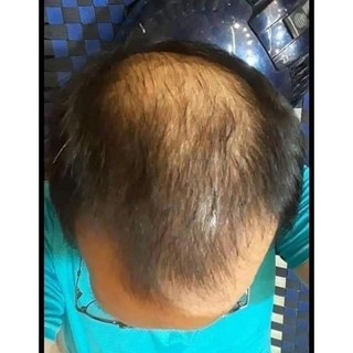 Dầu gội kích thích mọc tóc thanh_mộc_hương