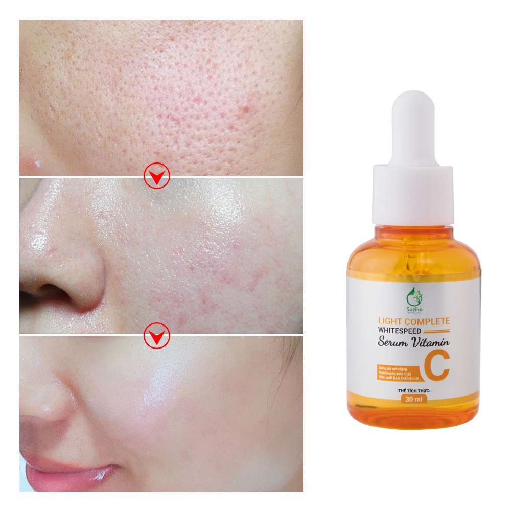 Serum Vitamin C sáng da mờ thâm SUZIKO siêu cấp ẩm giảm nếp nhăn 30ml