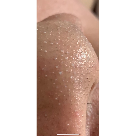 Ủ mụn Medipeel 100ml | BigBuy360 - bigbuy360.vn