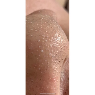 Ủ mụn Medipeel 100ml