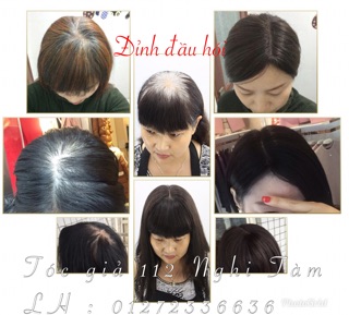 Tóc đỉnh đầu dành cho tóc thưa mỏng
