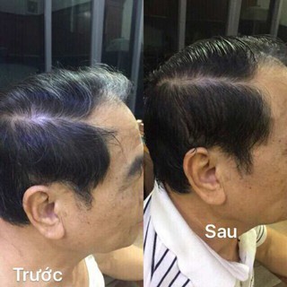 Dầu Gội Thảo Dược Tosmedy