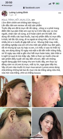 Serum LUMOS ACNE..