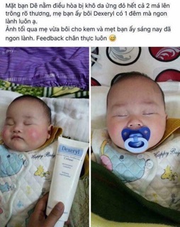 KEM NẺ DEXERYL PHÁP