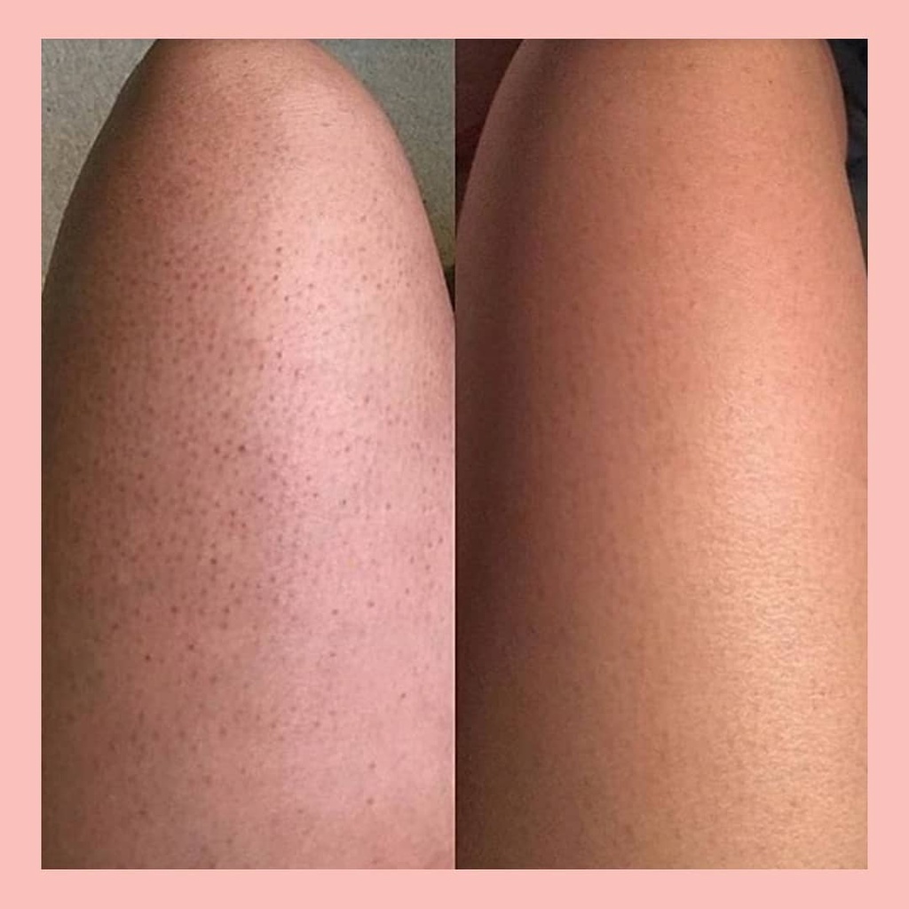 Tẩy da chết Frank Body coffee scrub fullsize 200g (mùi cinnabuns, a-beauty, rose gold shimmer) | BigBuy360 - bigbuy360.vn