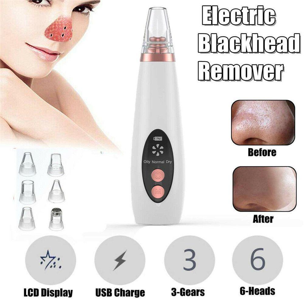 Máy Hút Mụn Đầu Đen Làm Sạch Sâu Da Mặt ESPO