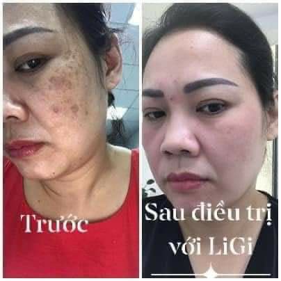 Sâm Tố Nữ LIGI | Thế Giới Skin Care