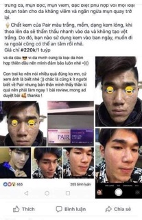 [Chọn size] Kem trị mụn pair Nhật Bản