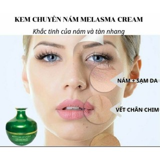 KEM NÁM HUỲNH ĐỖ