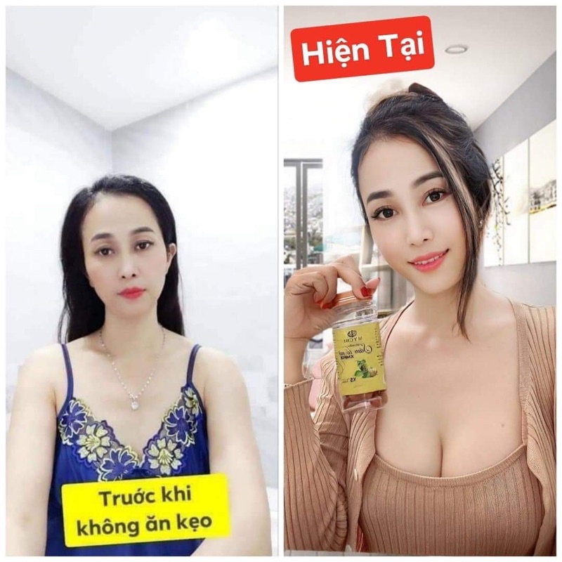 {MẪU MỚI] KẸO MẦM SÂM TỐ NỮ XMAX MYCHI Tăng v1 gấp 10 lần kẹo mầm sâm tố nữ Plus