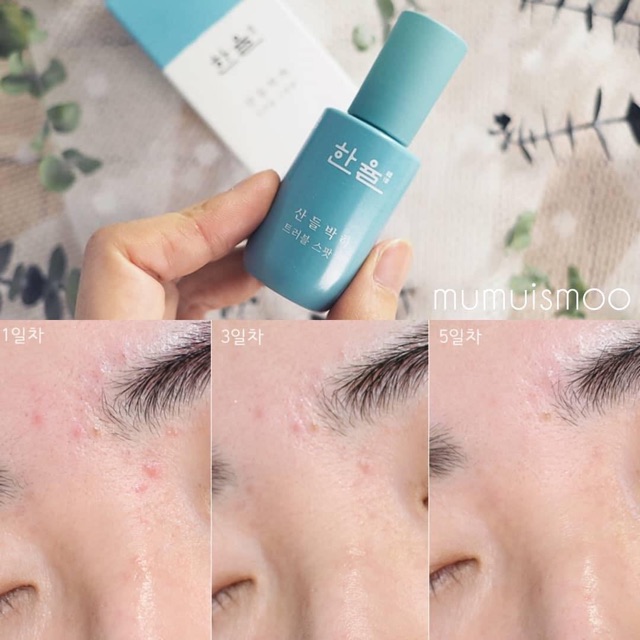 GEL NG.ỪA MỤN HANYUL MENTHA TROUBLE SPOT