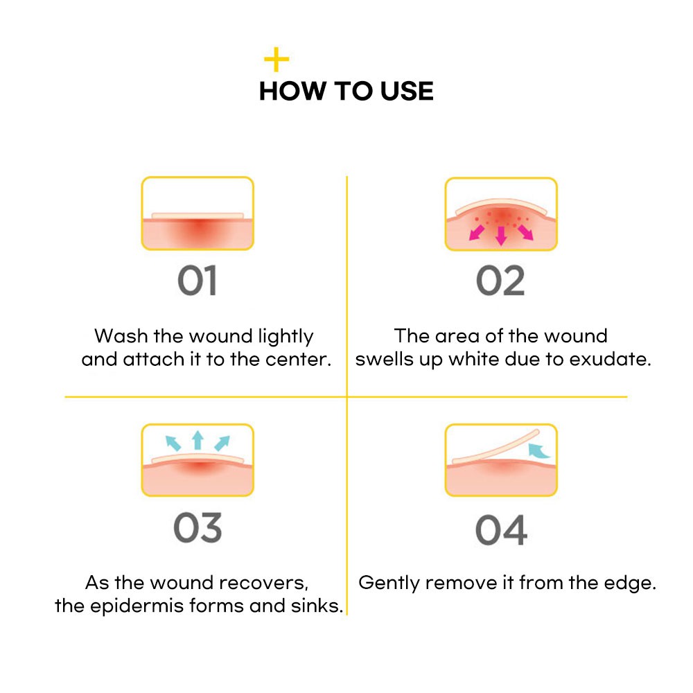 [OLIVE YOUNG] Miếng dán mụn bảo vệ vùng da tổn thương loại truyền thống 102ea / Mật ong 82ea | BigBuy360 - bigbuy360.vn