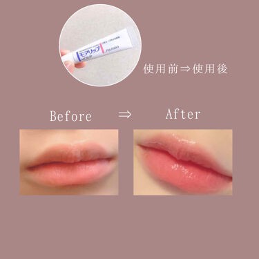 Son Dưỡng Môi Moilip Shiseido Nhật Bản