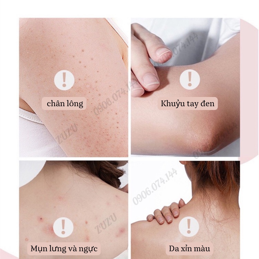 Tẩy tế bào chết, Tẩy Da Chết Body cải thiện da viêm lông sáng da Zu Cosmetic