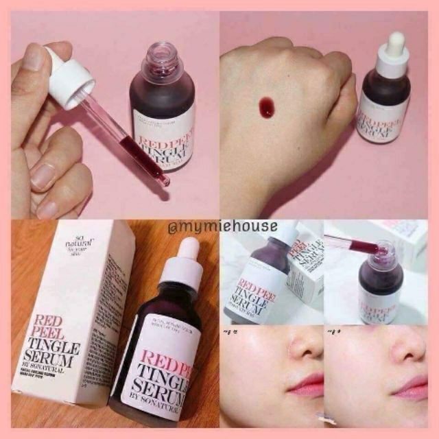 Tinh chất Red Peel Tingle Serum thay da sinh học Hàn Quốc | BigBuy360 - bigbuy360.vn