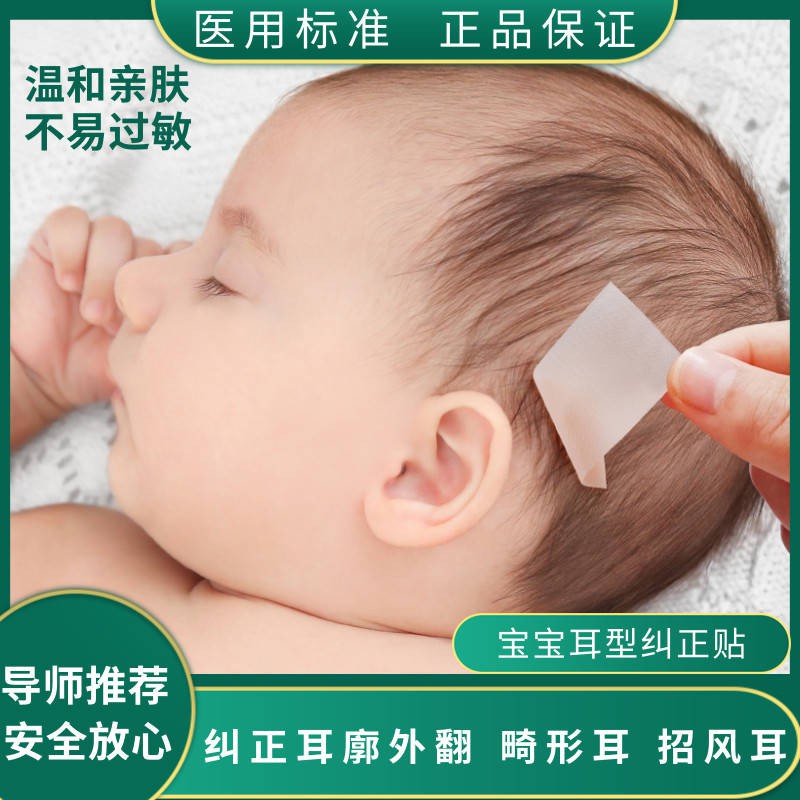 Infant silicone hồ sơ sửa chữa bé chống lừa đảo chính xác tai mới cố định biến dạng thể hiệnnội  địa