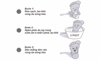 Miếng dán trị mắt cá,mụn cóc,mụn cơm 50k/túi
