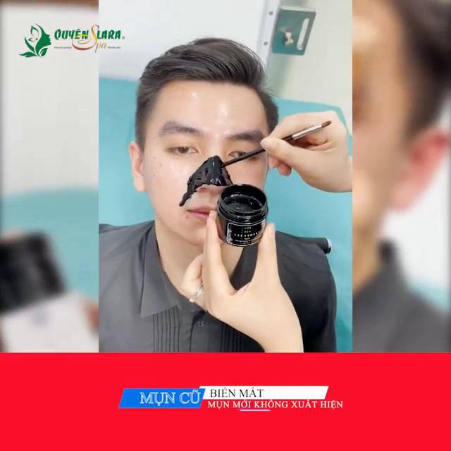 Gel Lột Mụn Đầu Đen Bùn Khoáng Quyên Lara,Lột Sạch Mụn Cám,Đầu Đen Ngay Sau Lần Sử Dụng Đầu Tiên 50g