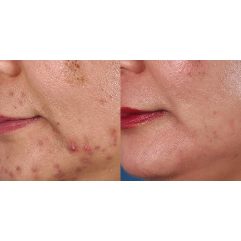 Kem tẩy tế bào chết Exfoliating Polish