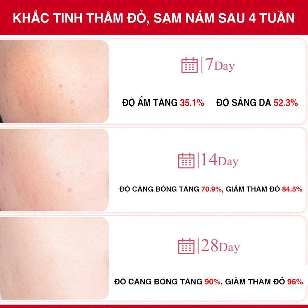 Combo 2 Sản Phẩm Giảm Thâm Đỏ, Mờ Sạm Nám Chuyên Sâu Angel's Liquid Tranexamic Mela (Siêu Tinh Chất 30ml + Kem Nám 50ml)