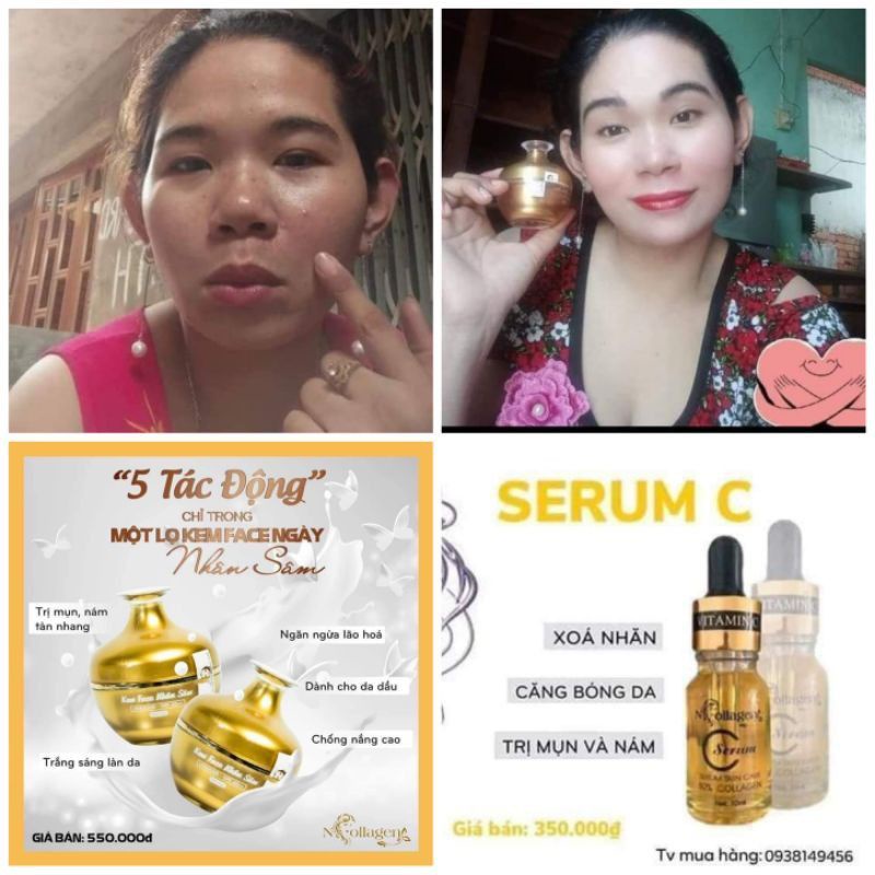Combo kem nhân sâm & serum C
