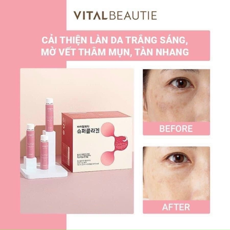 Nước Uống Collagen VB Hàn Quốc Hỗ Trợ Làm Đẹp Và Ngăn Ngừa Lão Hóa Vital Beautie Super Hộp 30 Ống x 25ml