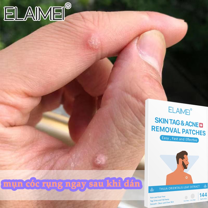 Không để lại sẹo！ ELAIMEI Miếng dán plasters Mụn cóc,Miếng dán tẩy mụn cóc 144 bài ngăn chặn mụn cóc hiệu quả