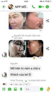 Mỡ trăn N’store 5k